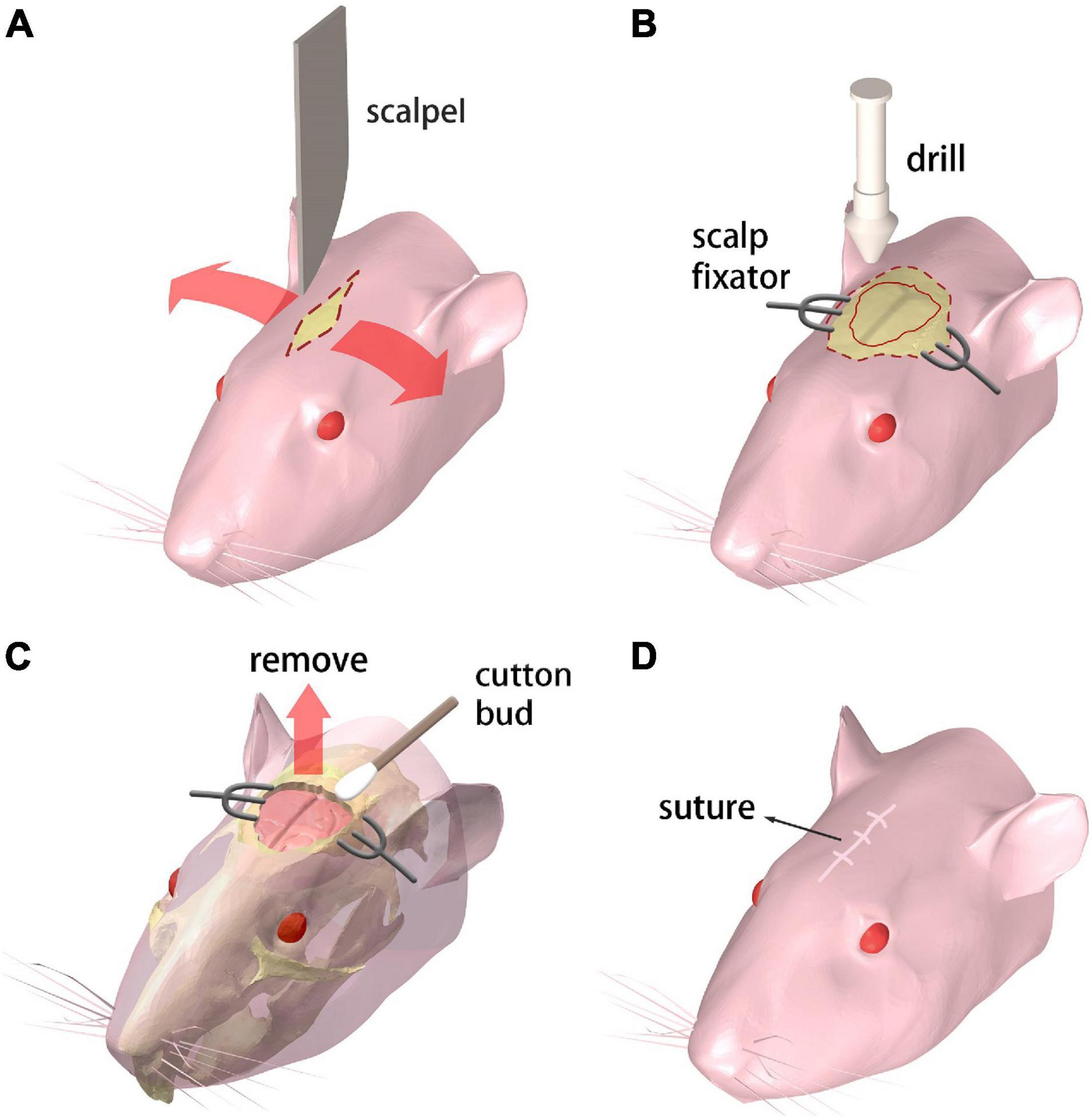 Frontiers | A Skull-Removed Chronic Cranial Window for Ultrasound and  Photoacoustic Imaging of the Rodent Brain