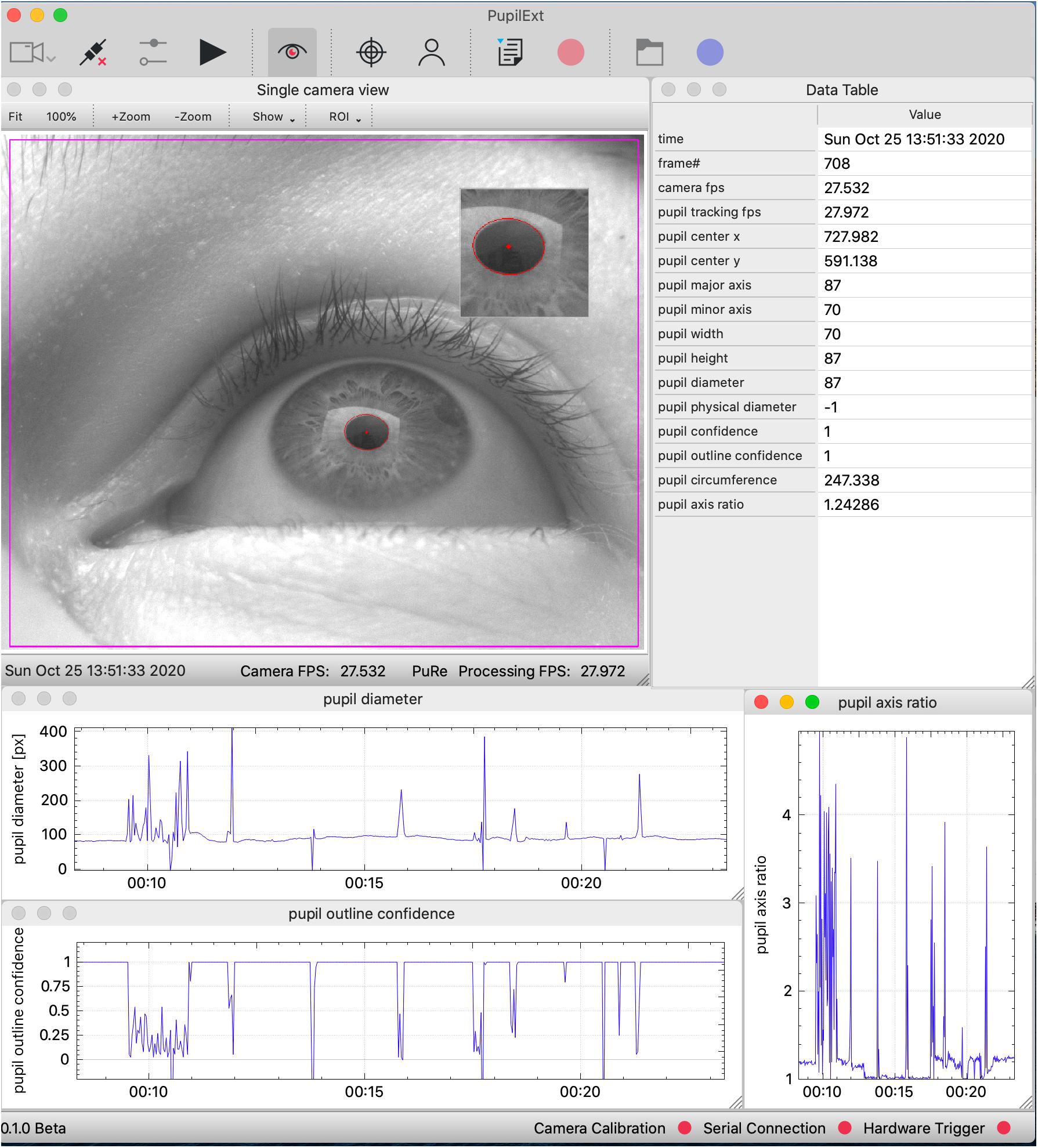 Frontiers  PupilEXT: Flexible Open-Source Platform for High-Resolution  Pupillometry in Vision Research