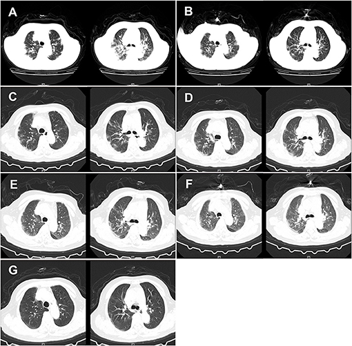 clinical case study on covid 19 www.frontiersin.org