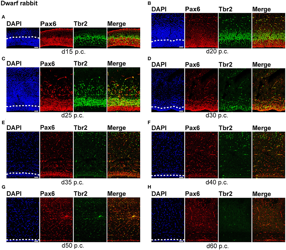 Frontiers | Developmental Differences in Neocortex ...