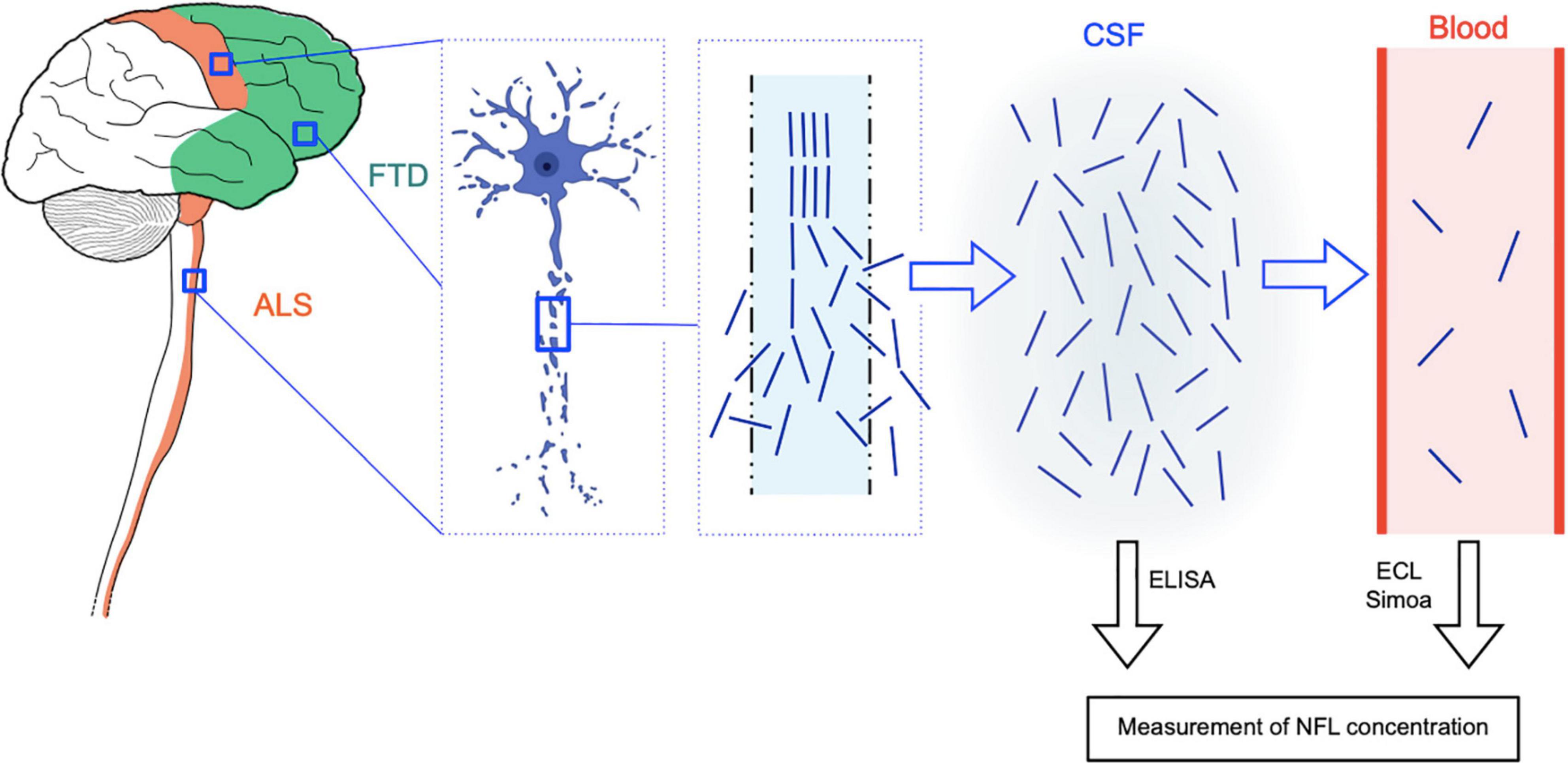 partner løber tør svejsning Frontiers | Neurofilament Light Chain as Biomarker for Amyotrophic Lateral  Sclerosis and Frontotemporal Dementia