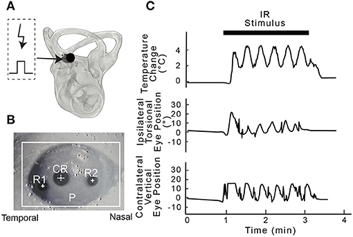 Effects of electrical muscle stimulation on cerebral blood flow, BMC  Neuroscience