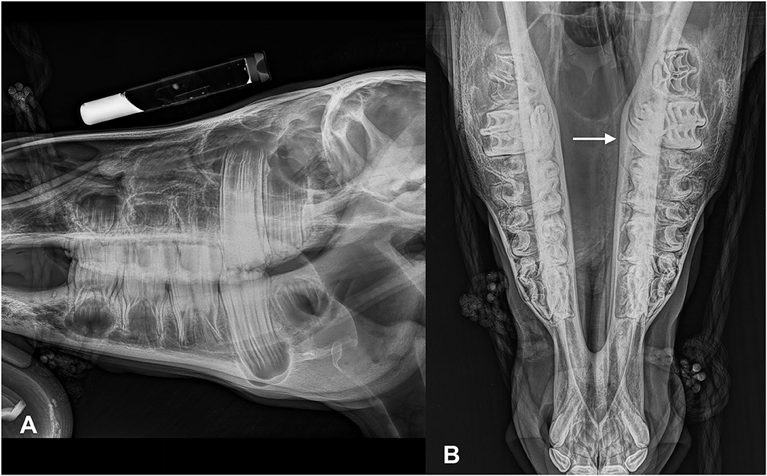 Maxillary sinus disease: diagnosis and treatment