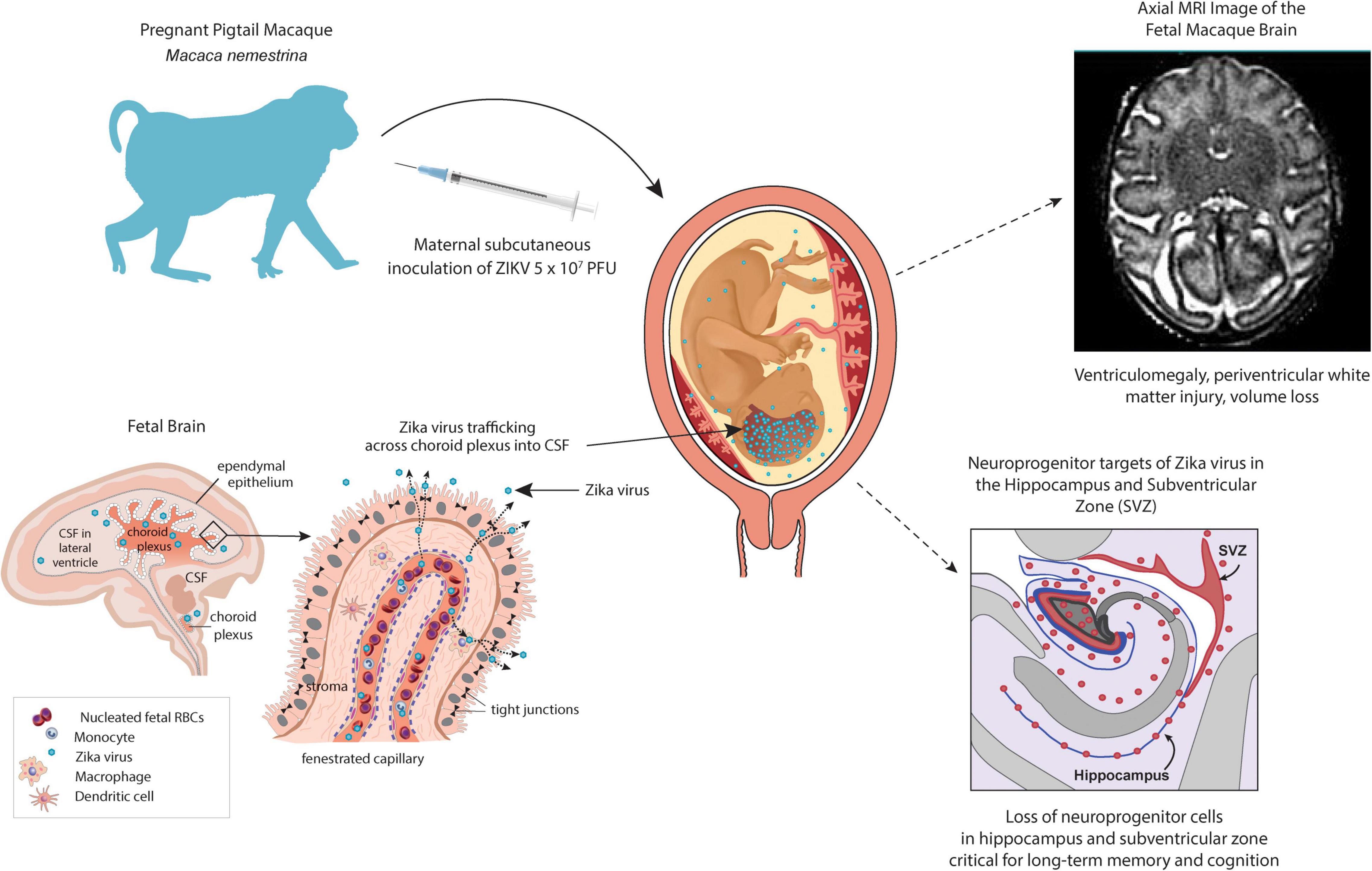 Frontiers | Non-human Primate Models to Investigate Mechanisms of  Infection-Associated Fetal and Pediatric Injury, Teratogenesis and  Stillbirth