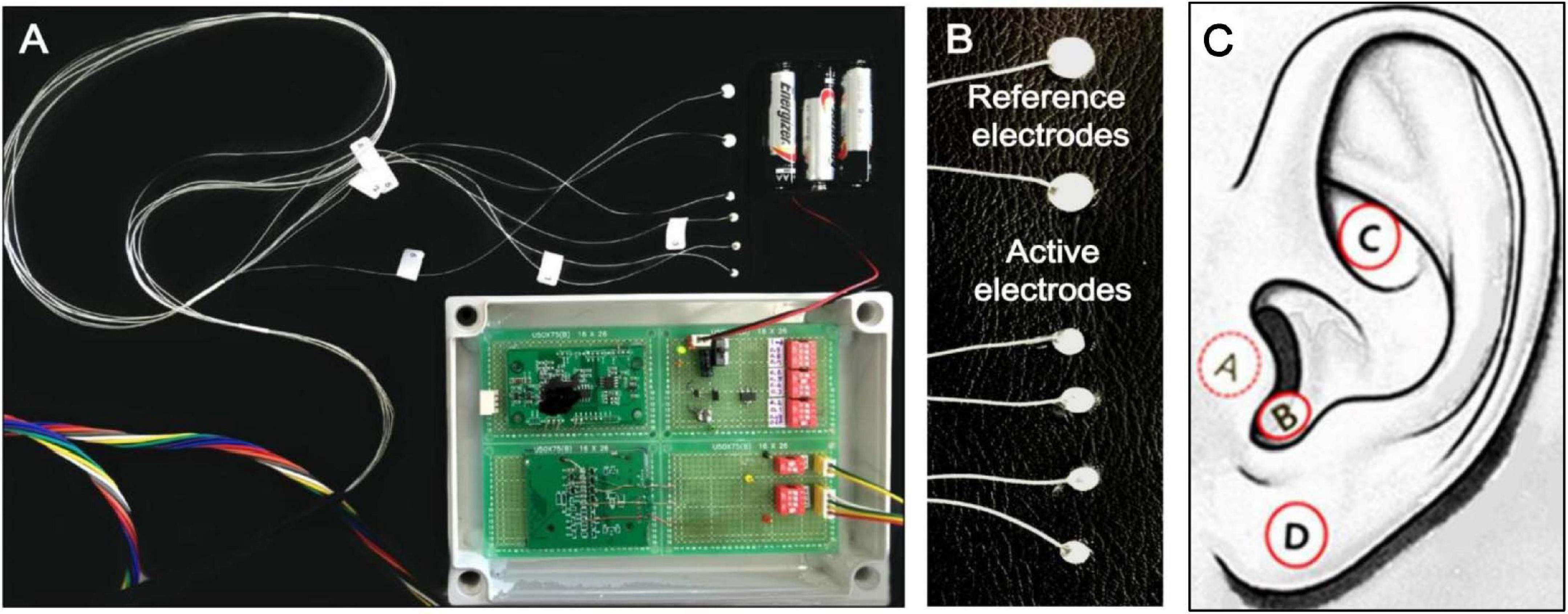 Frontiers  Critical Review of Transcutaneous Vagus Nerve