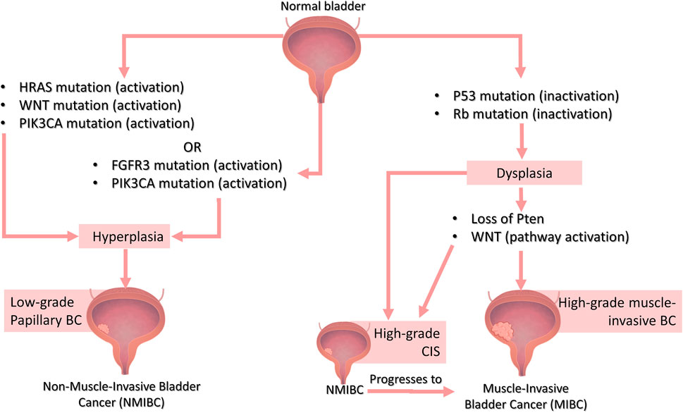 Pathophysiology Of Bladder Cancer
