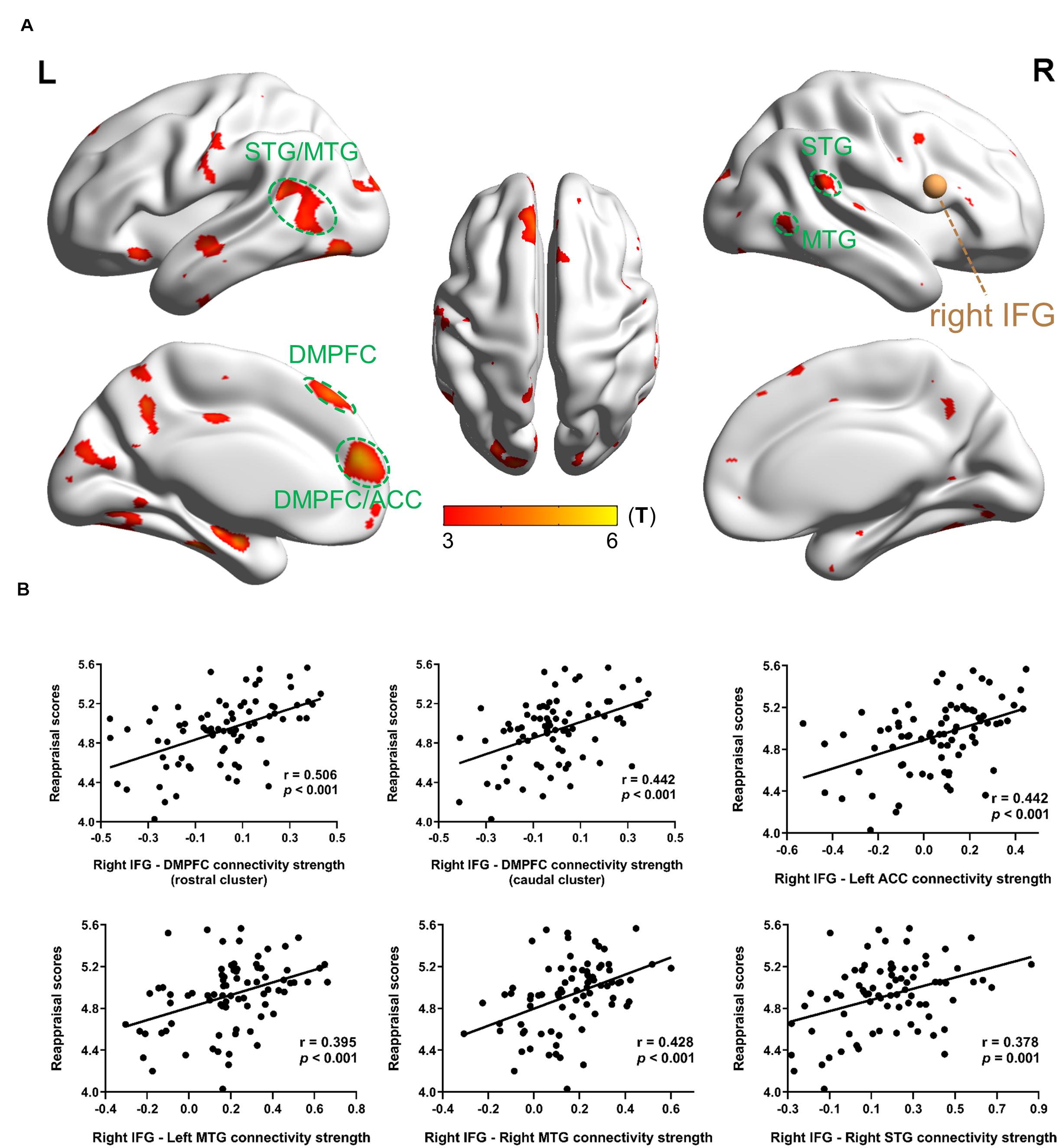 Frontiers  Inferior Frontal Gyrus-Based Resting-State Functional  Connectivity and Medium Dispositional Use of Reappraisal Strategy
