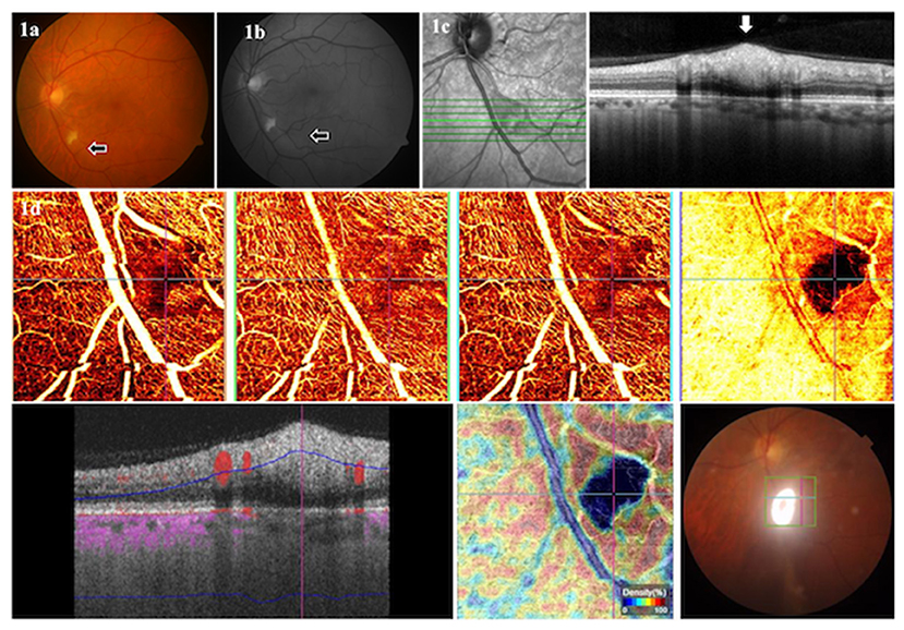 Home Page: Ophthalmology Retina