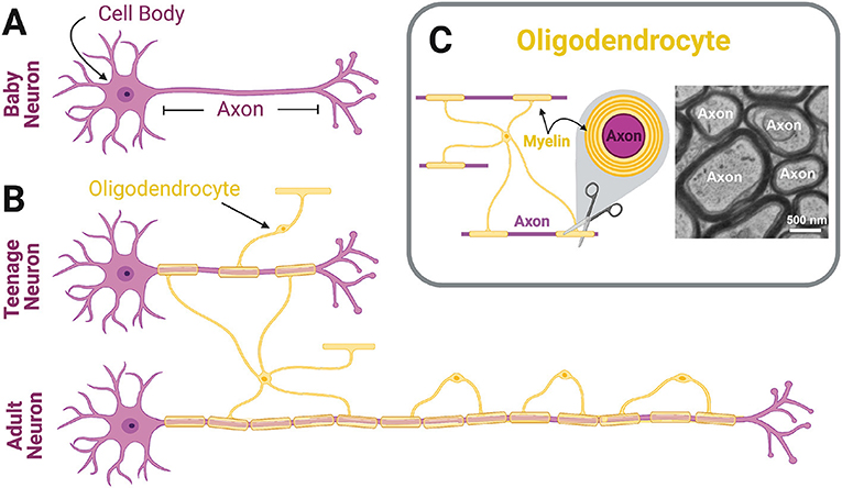 Figure 1 - (A) In babies, neurons do not have any myelin covering them.