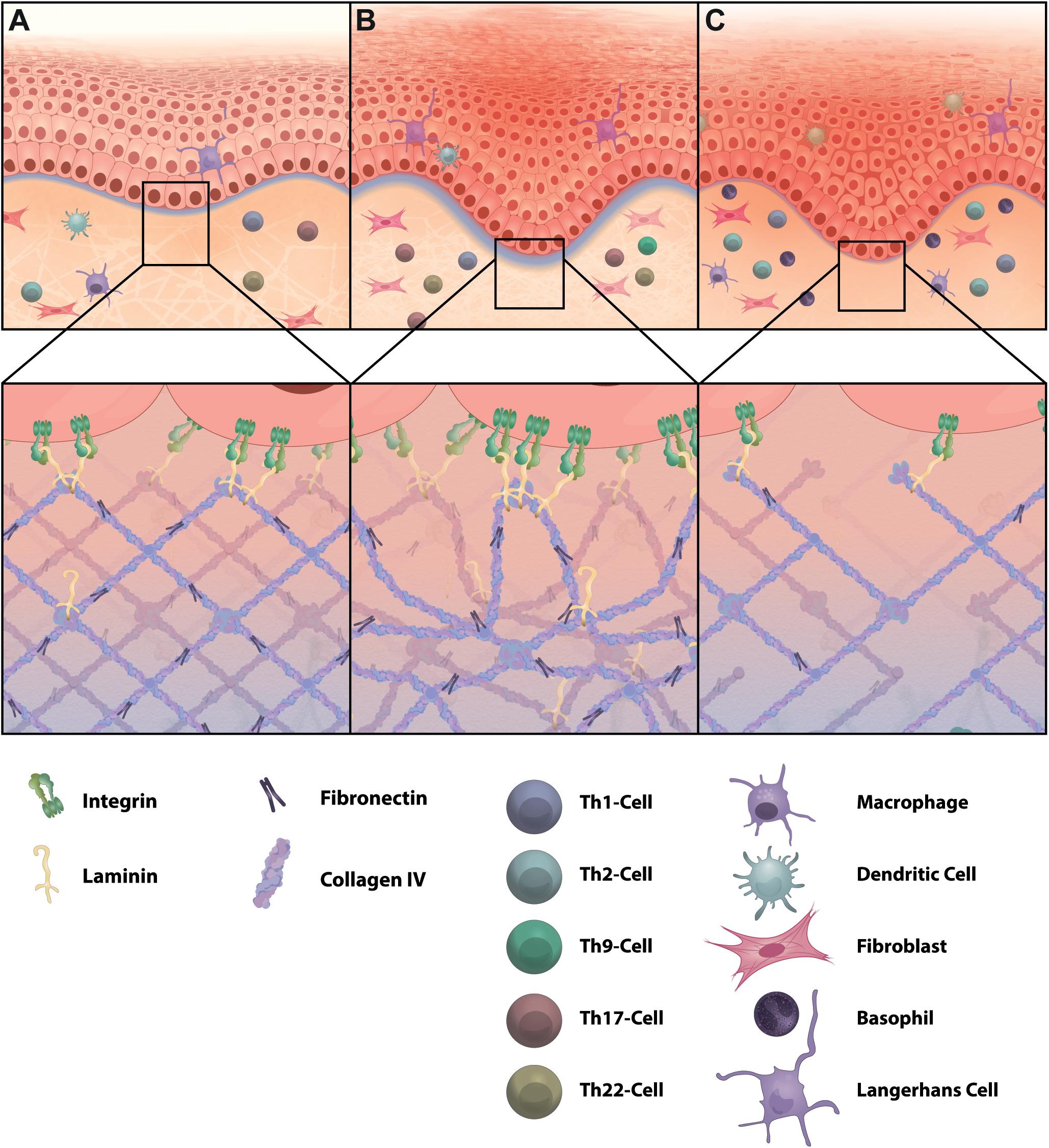 Frontiers  The Extracellular Matrix in Skin Inflammation and Infection