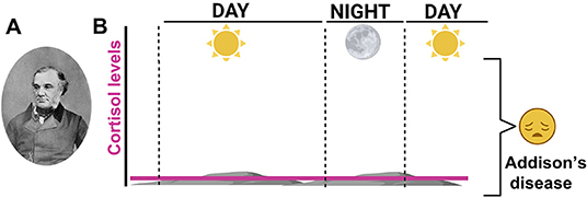图3 - (A)托马斯·艾迪生(1793-1860)是一位英国医生，他首先描述了肾上腺功能不全，后来被命名为艾迪生病。