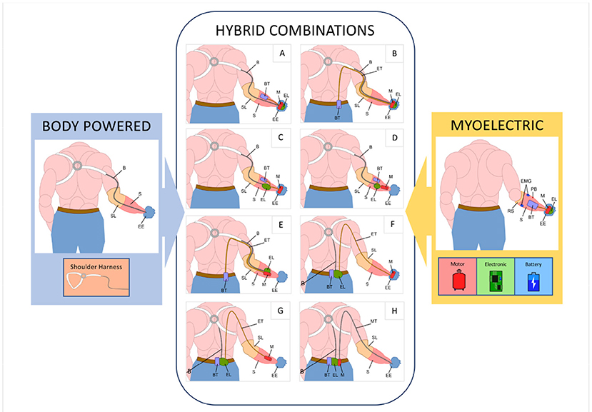 Lower Limb Prosthesis 101: Knowledge is Power