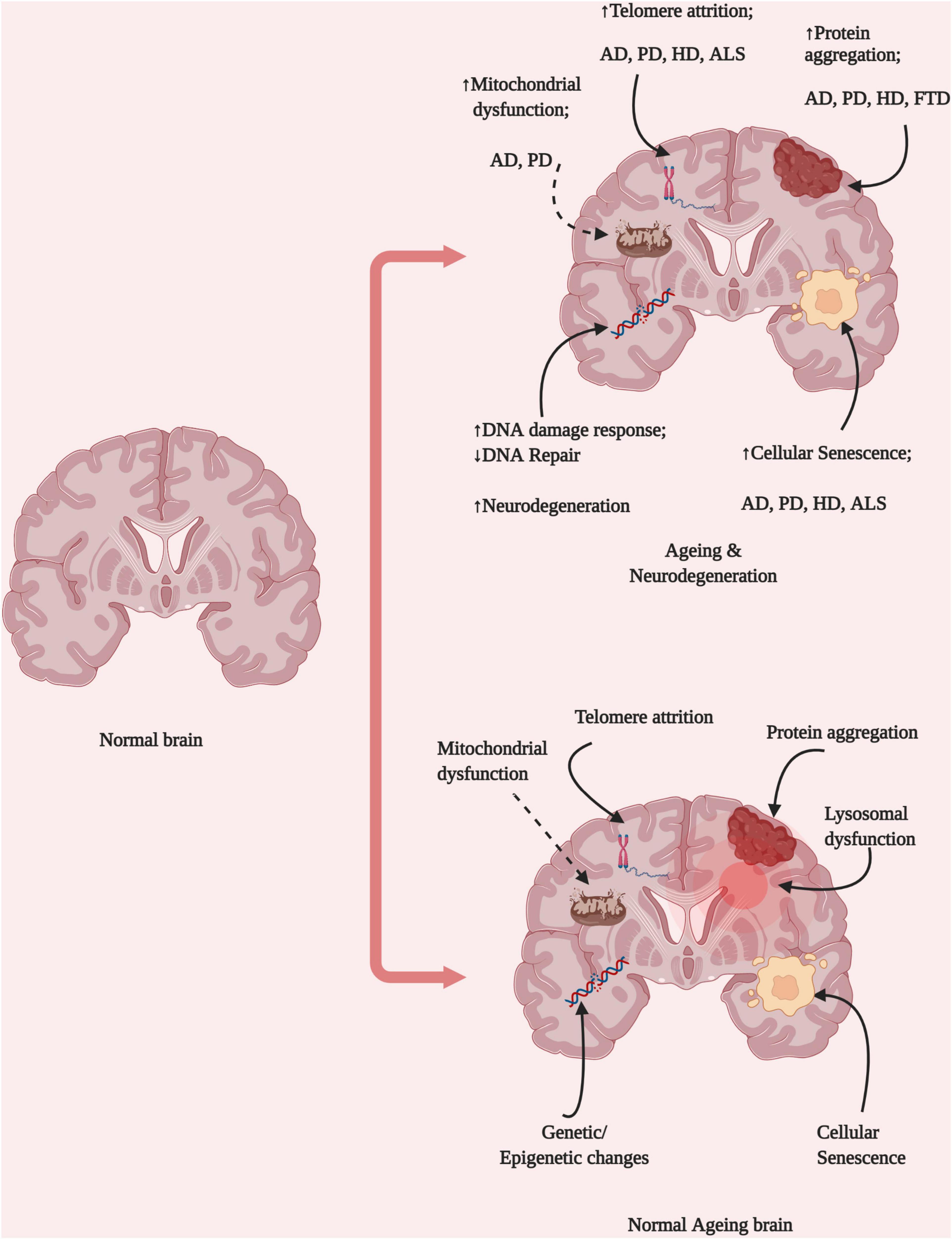 Metabolite Toxicity as a Driver of Aging and Disease — THE HUGHES LAB