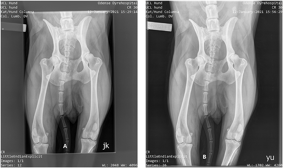 The 15% Rule In Radiography (kVp Impact To MAs) • How Radiology Works