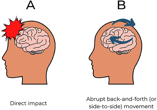 A Sport Where You Purposely Incur Head Injuries?