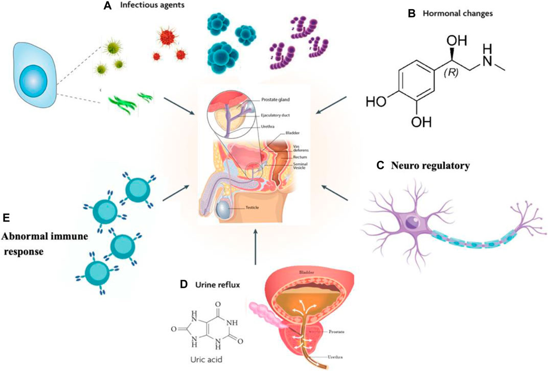 anti prostatitis nano