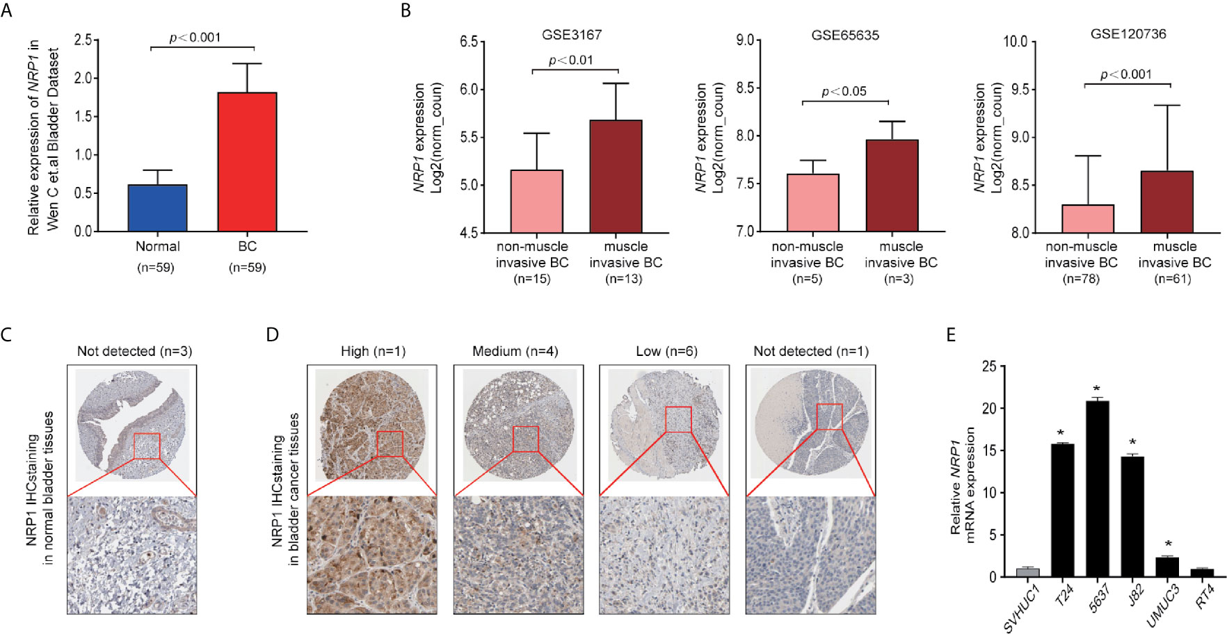 Frontiers | Role NRP1 in Bladder Cancer Pathogenesis and Progression