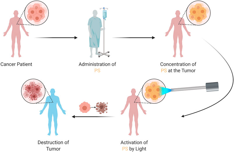 ovarian malignant mesothelioma