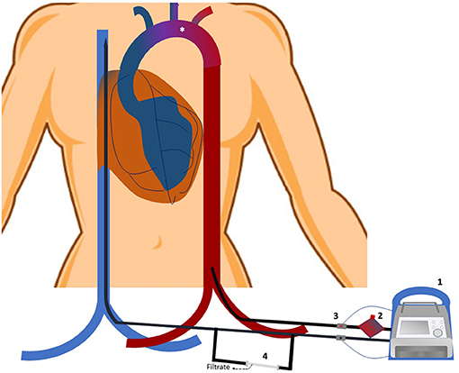 Prép'Parts Technique 205, circuit de contrôle ventilateurs