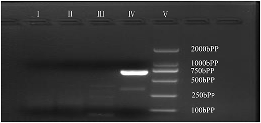 Frontiers  Case Report: Low-Level Maternal Mosaicism of a Novel CREBBP  Variant Causes Recurrent Rubinstein-Taybi Syndrome in Two Siblings of a  Chinese Family