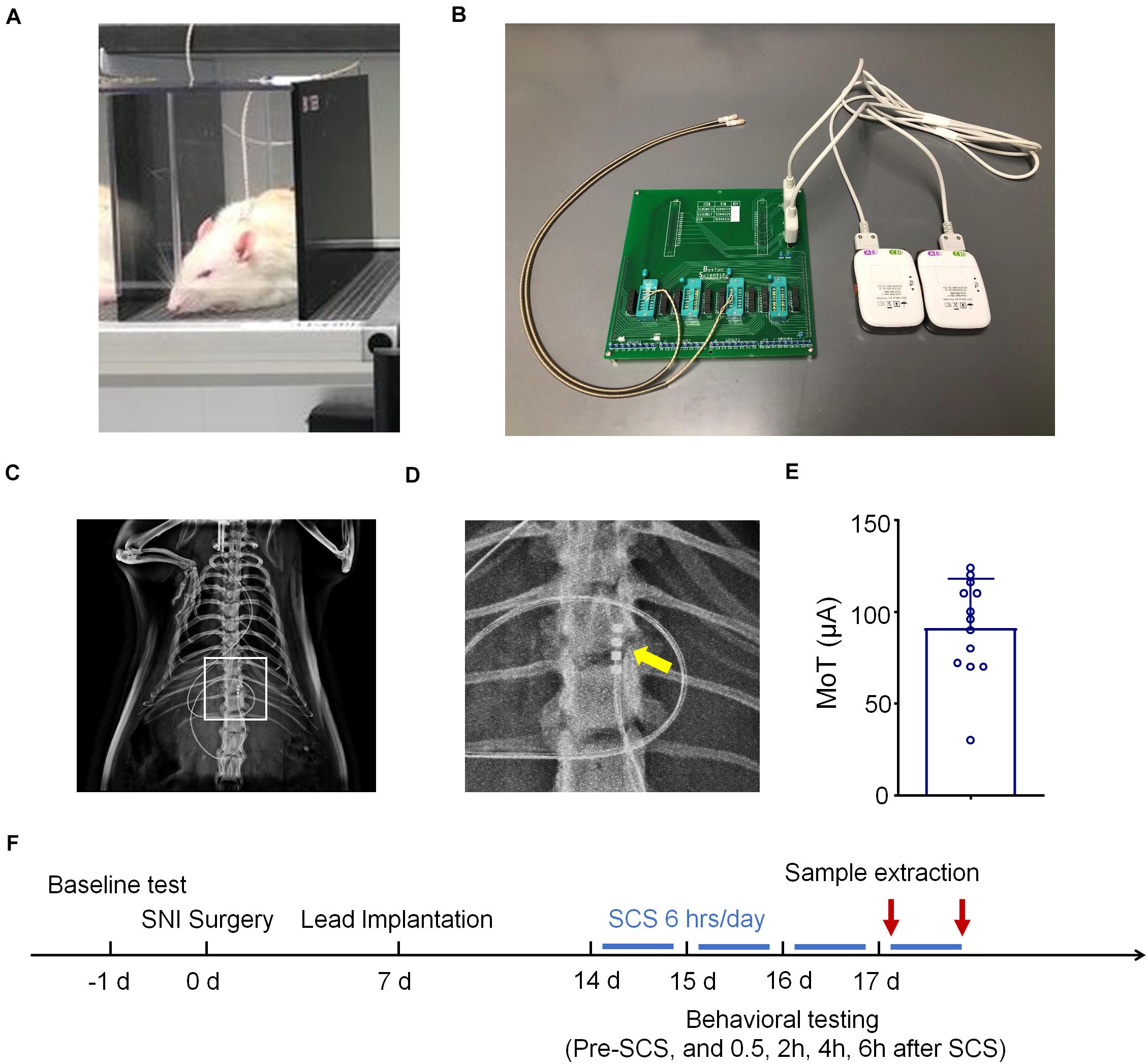 How Advanced Spinal Cord Stimulators Offer Drug-Free Relief of