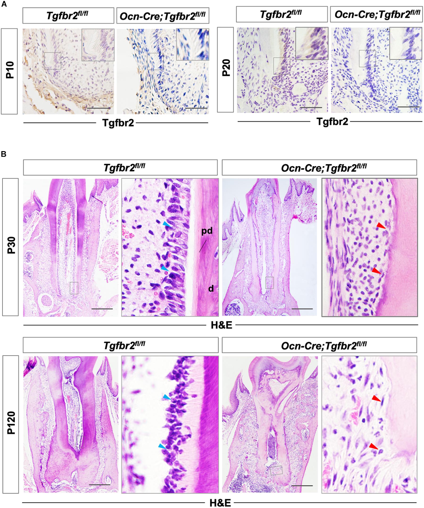 Substrate Compliance Directs the Osteogenic Lineages of Stem Cells from the  Human Apical Papilla via the Processes of Mechanosensing and  Mechanotransduction