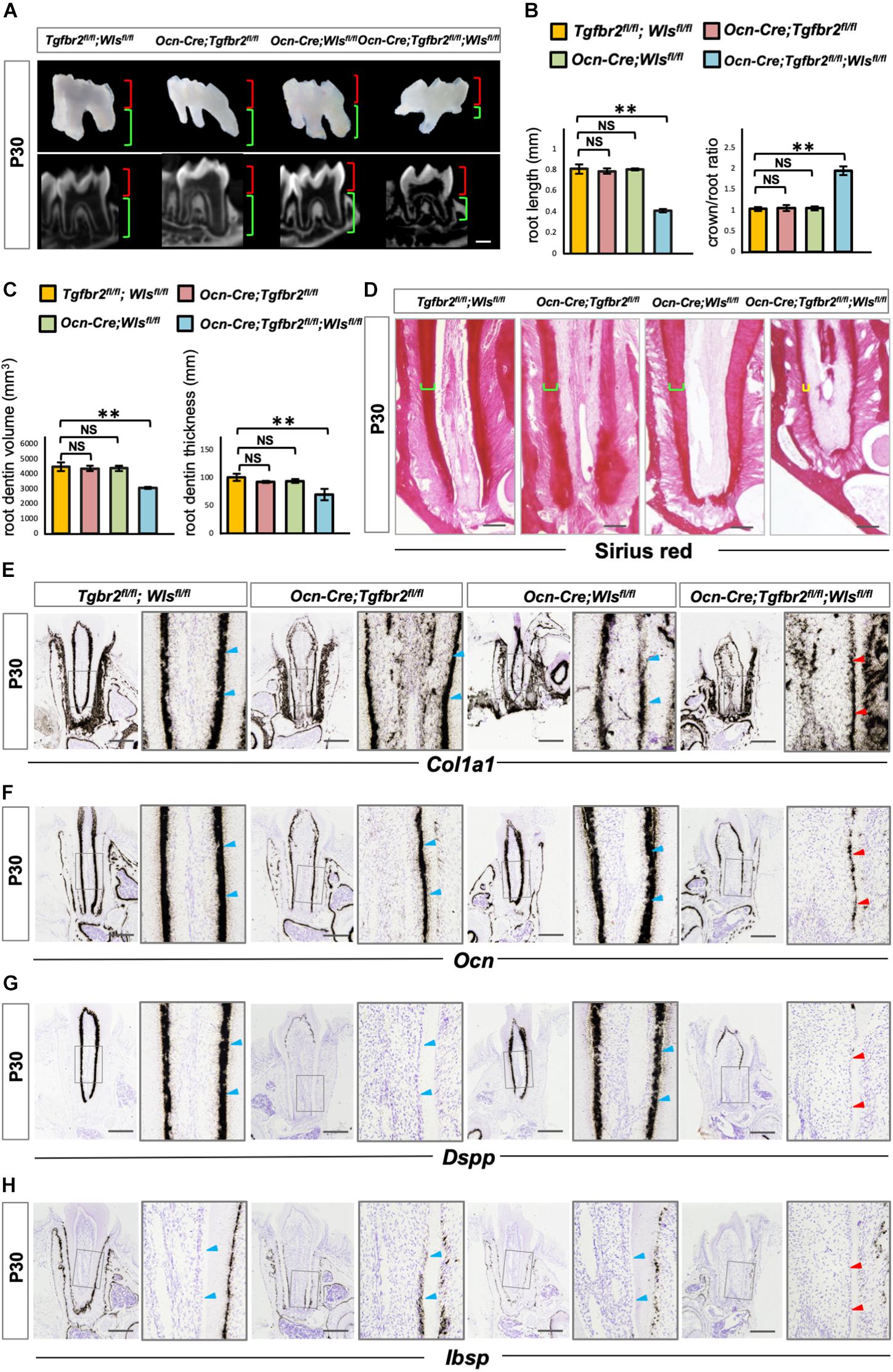 Substrate Compliance Directs the Osteogenic Lineages of Stem Cells from the  Human Apical Papilla via the Processes of Mechanosensing and  Mechanotransduction