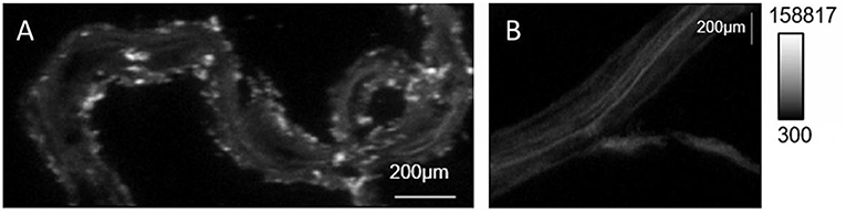 Figure 3 - Images of phosphorus in poplar roots, taken with a high-tech microscope.