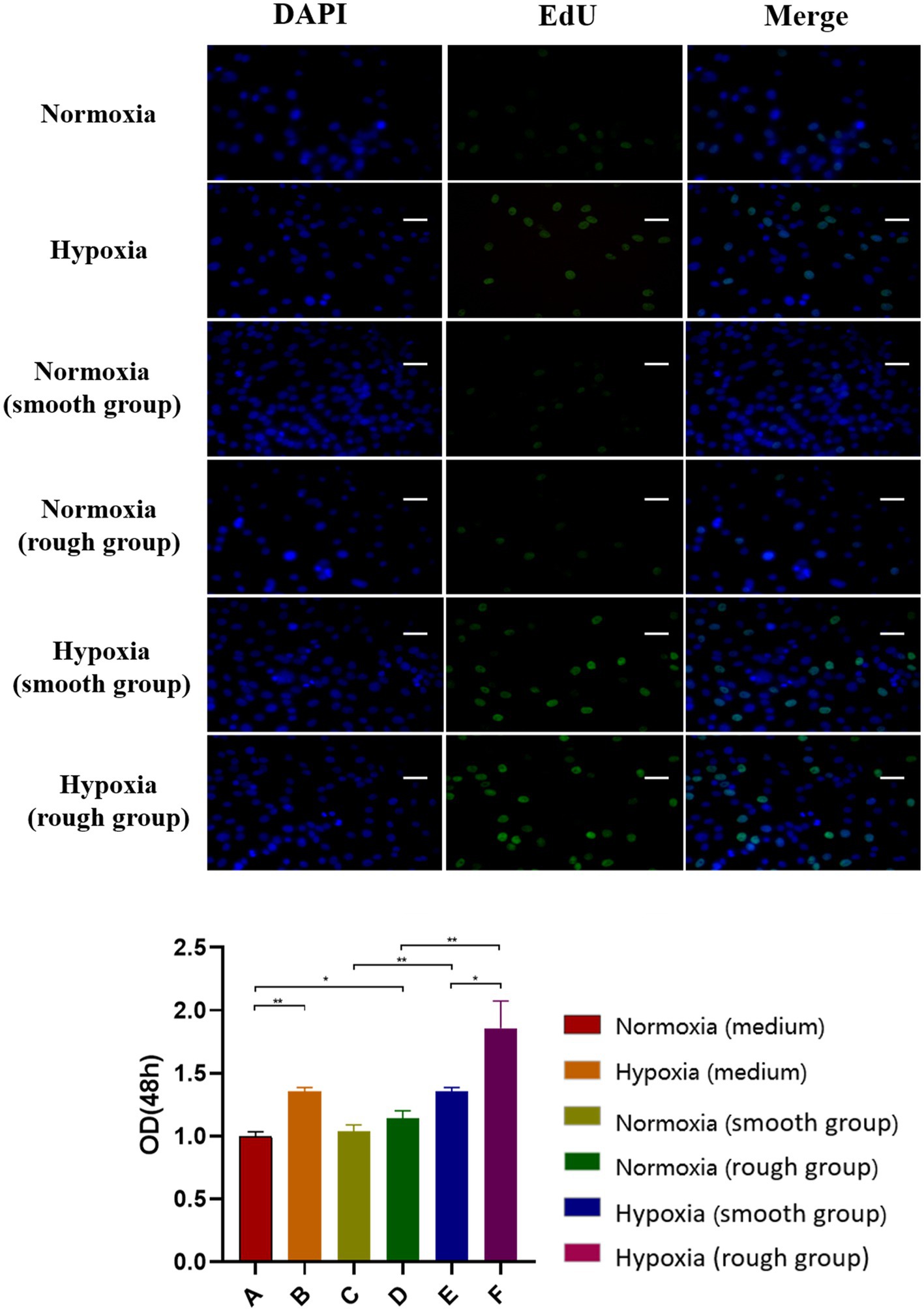 Frontiers  Impact of High-Altitude Hypoxia on Bone Defect Repair