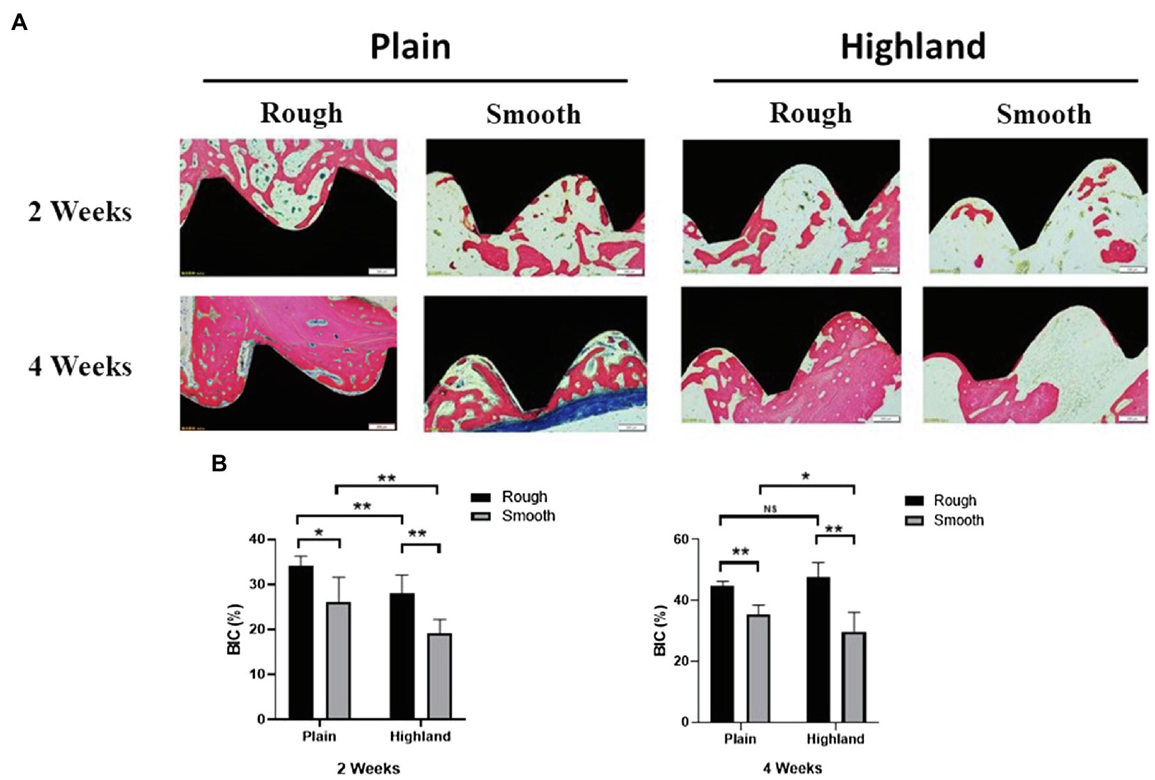 Frontiers  Impact of High-Altitude Hypoxia on Bone Defect Repair