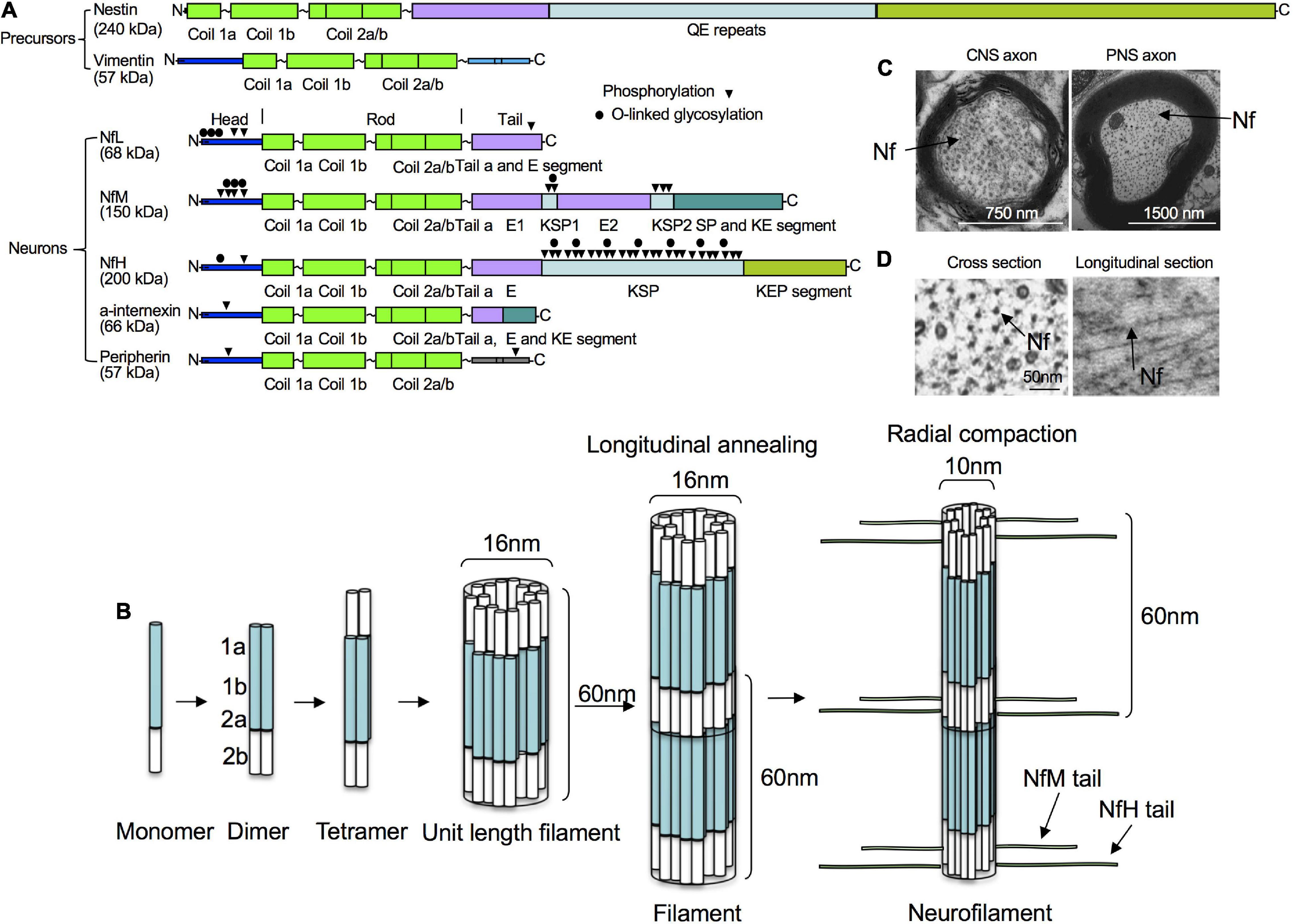 NfL as a biomarker for neurodegeneration and survival in Parkinson