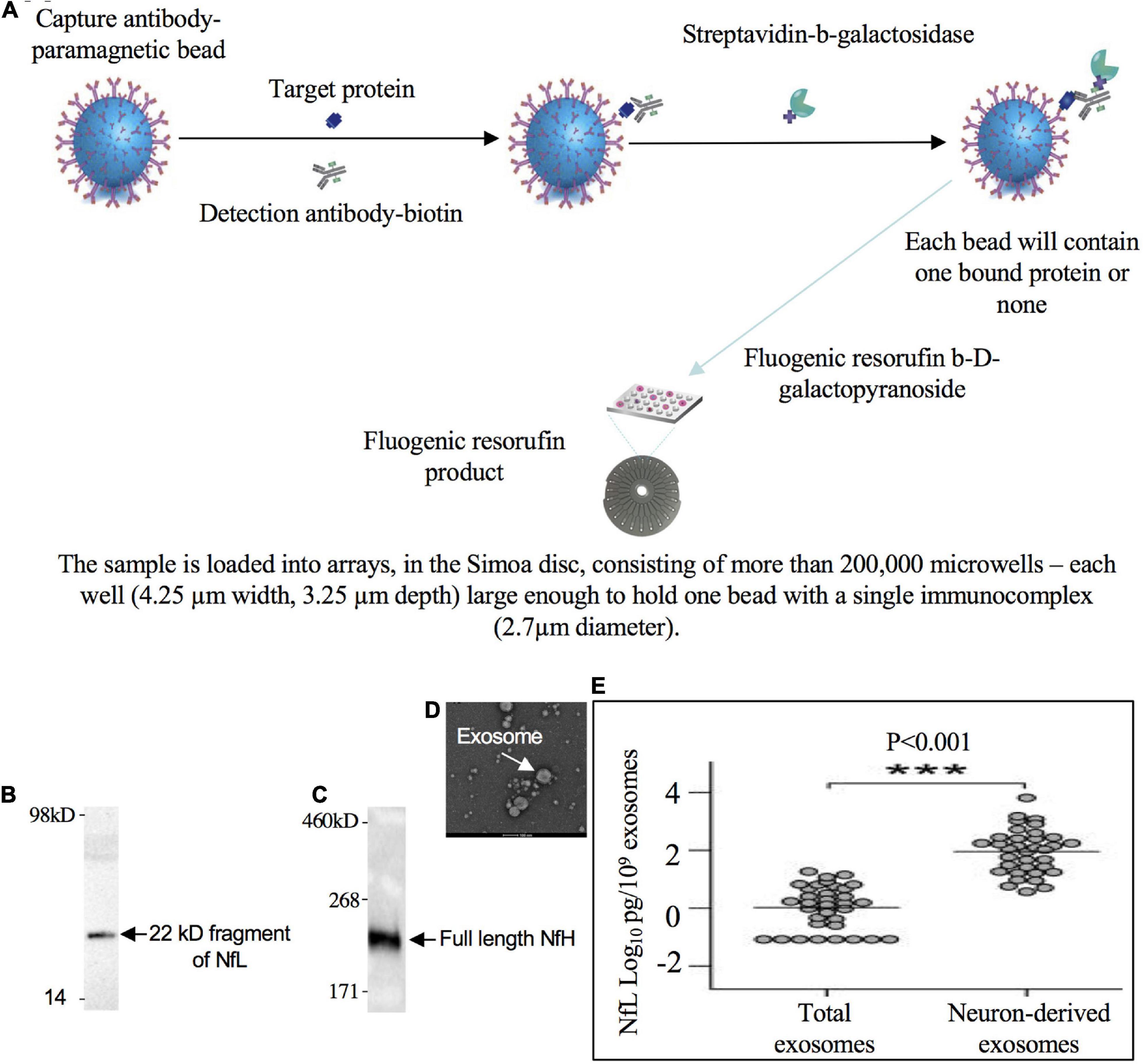 NfL as a biomarker for neurodegeneration and survival in Parkinson