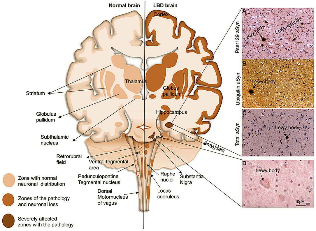 Frontiers | Alpha-Synuclein Post-translational Modifications: Implications  for Pathogenesis of Lewy Body Disorders