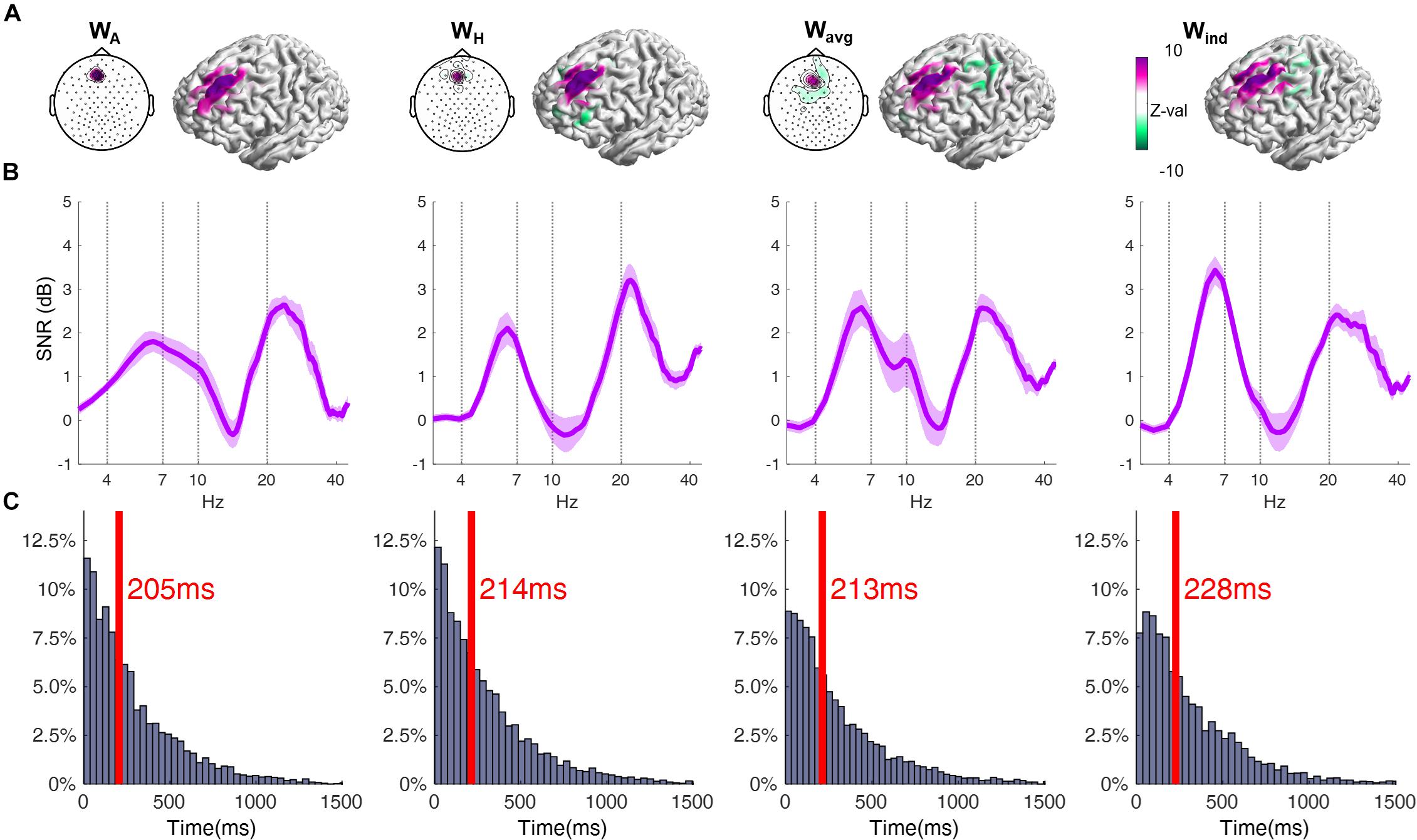 TMS EEG. Theta Burst TMS. Intermittent Theta Burst stimulation. EEG cap response to Electric Shock. Plot show