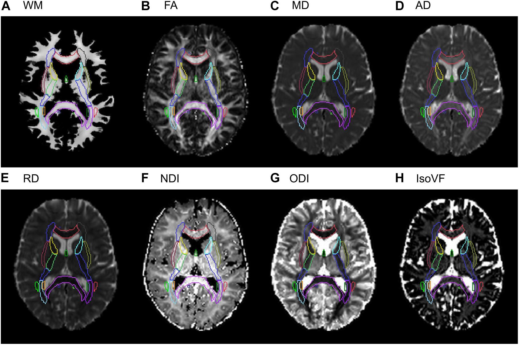 Frontiers  Age-Related Variations in Regional White Matter Volumetry and  Microstructure During the Post-adolescence Period: A Cross-Sectional Study  of a Cohort of 1,713 University Students