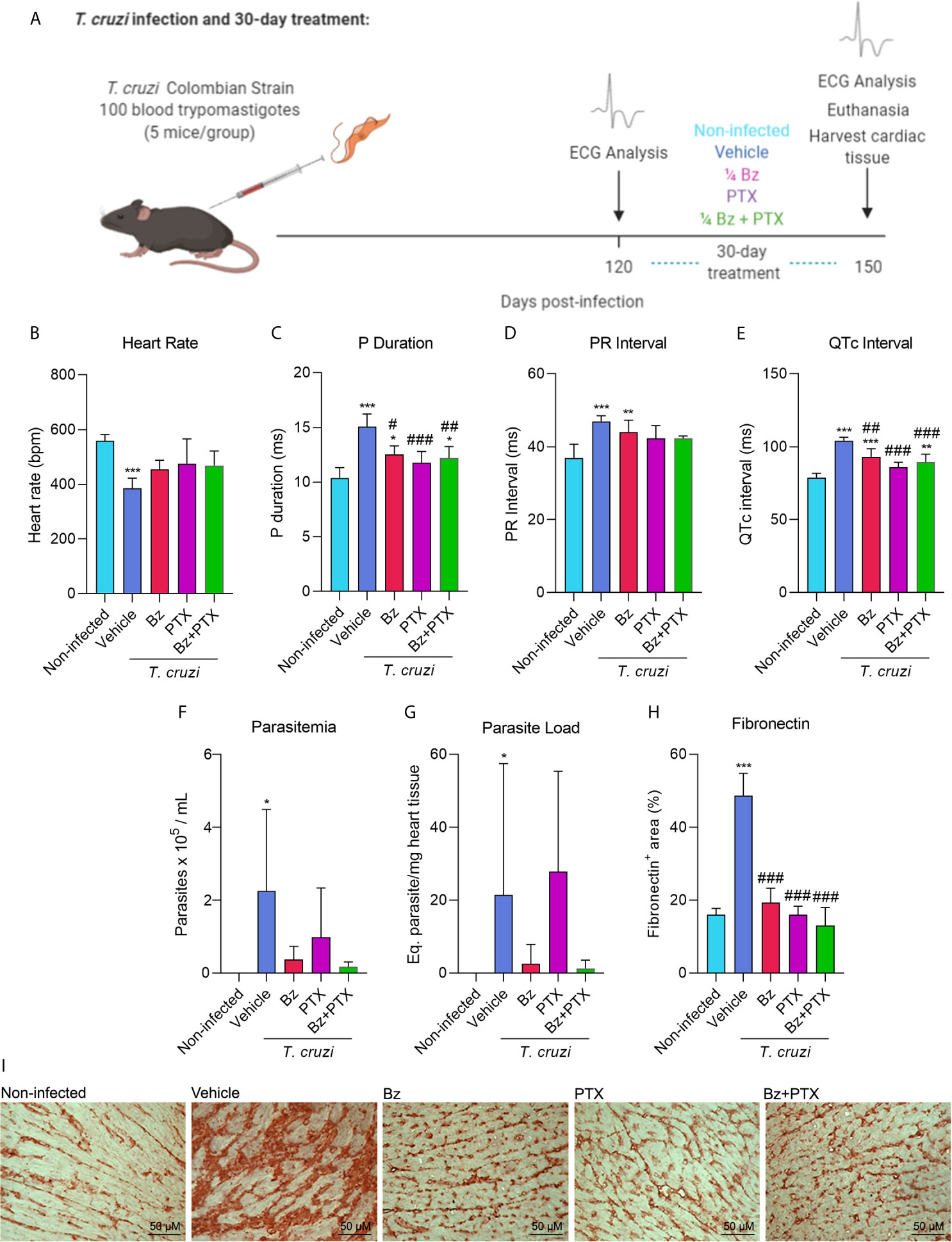 Frontiers  Comparative microRNA profiling of Trypanosoma cruzi infected  human cells