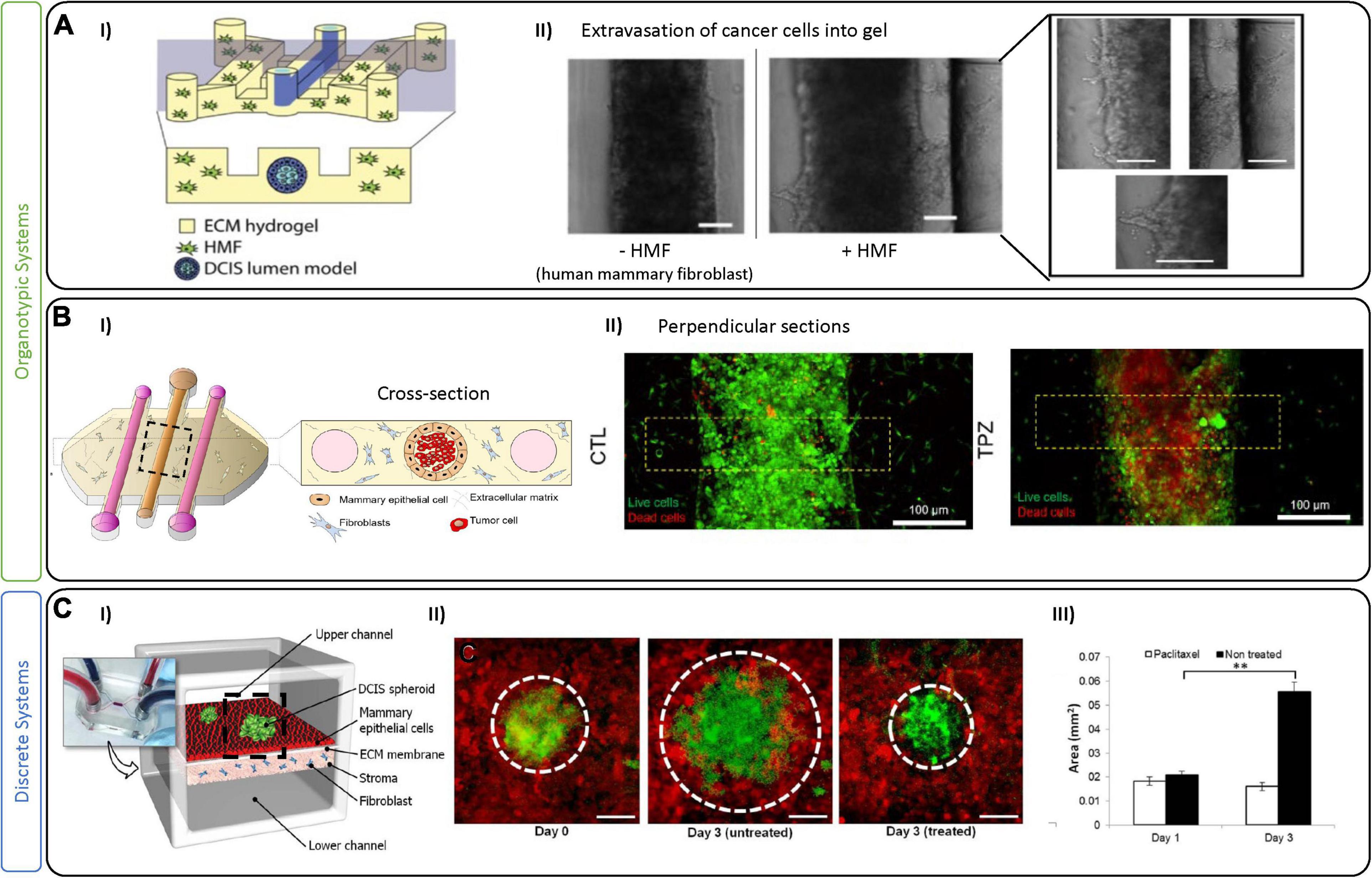 Frontiers  Engineering Breast Cancer On-chip—Moving Toward Subtype  Specific Models