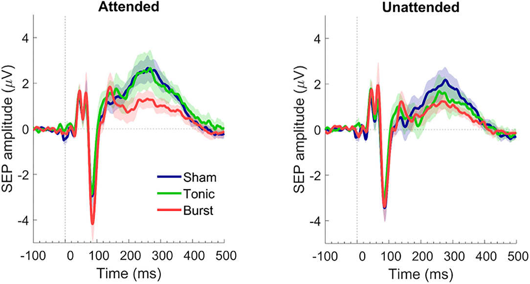 Somatosensory evoked potentials wiki