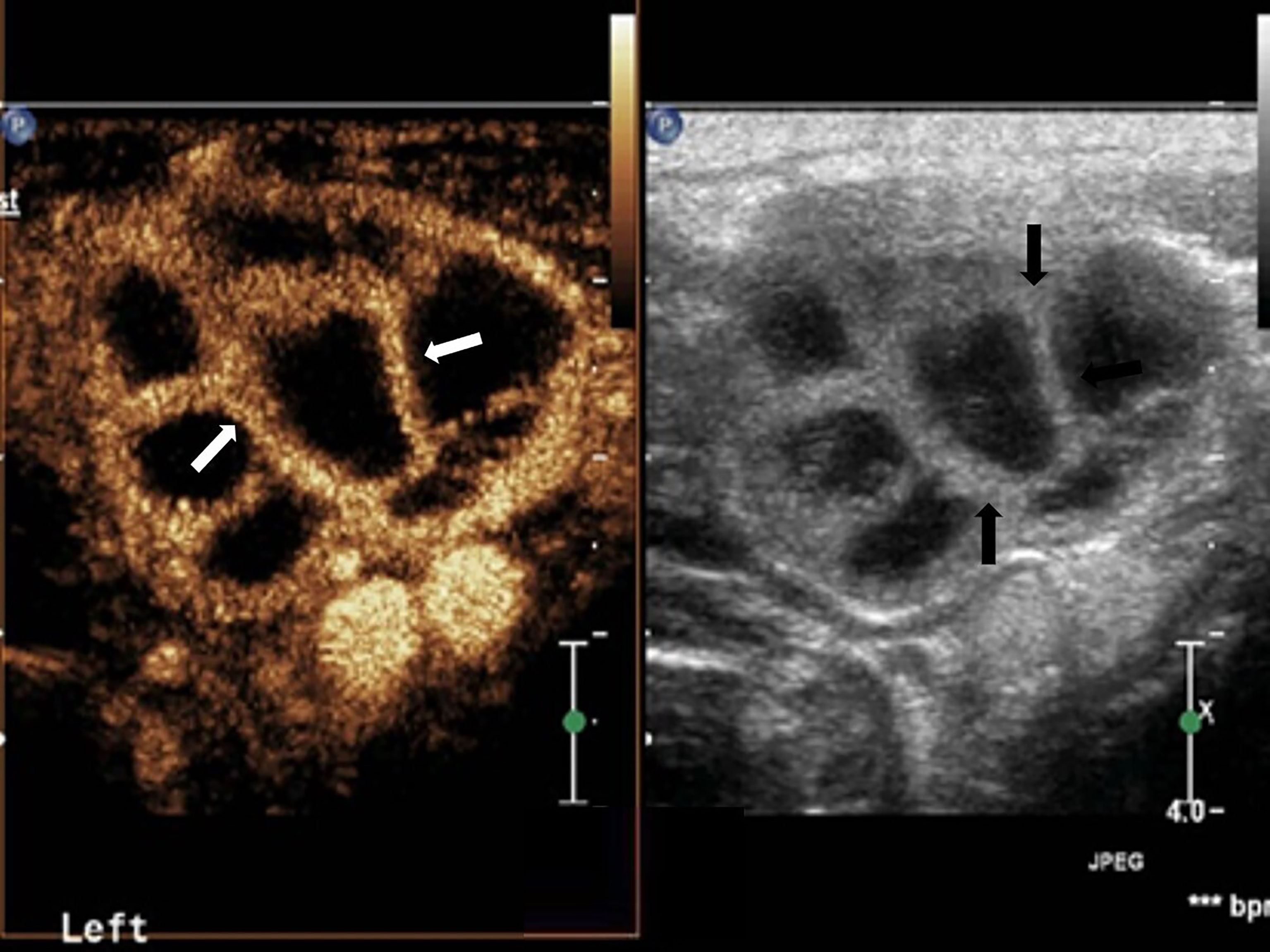 Frontiers Reassessing The Value Of Contrast Enhanced Ultrasonography