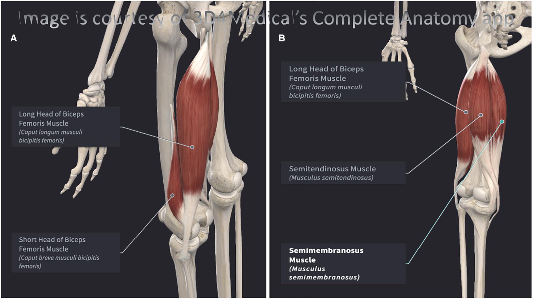 Flank Region of the Anatomy - Trial Exhibits Inc.