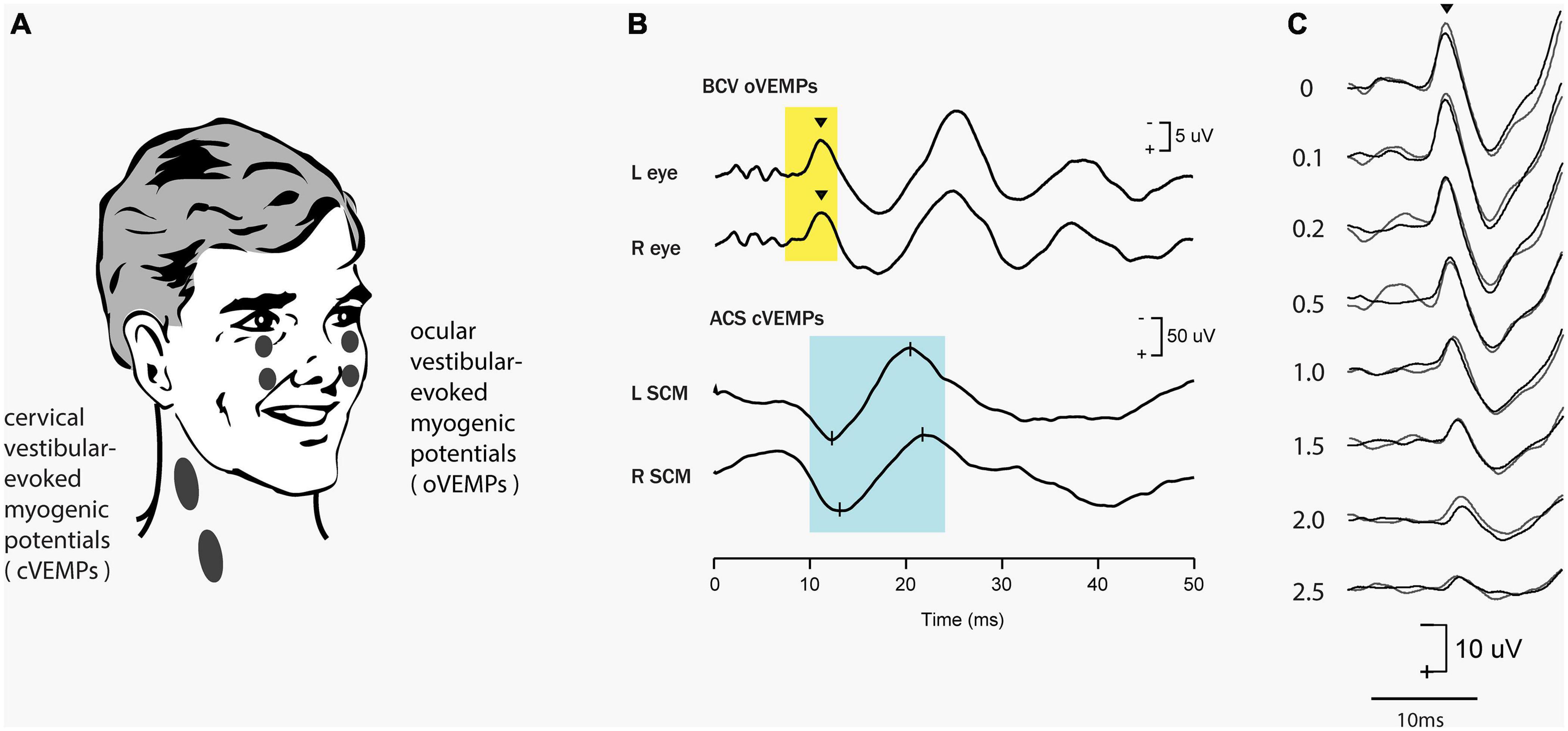 Frontiers  Similarities and Differences Between Vestibular and