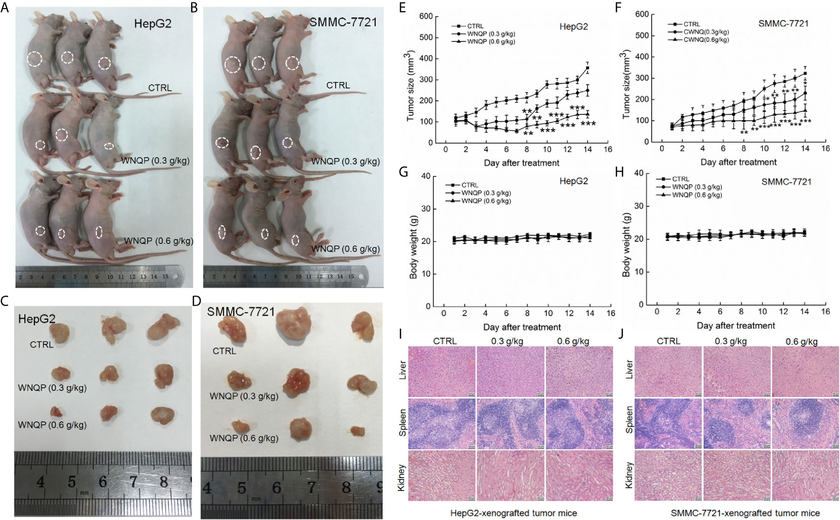 Frontiers Wan Nian Qing A Herbal Composite Prescription Suppresses The Progression Of Liver