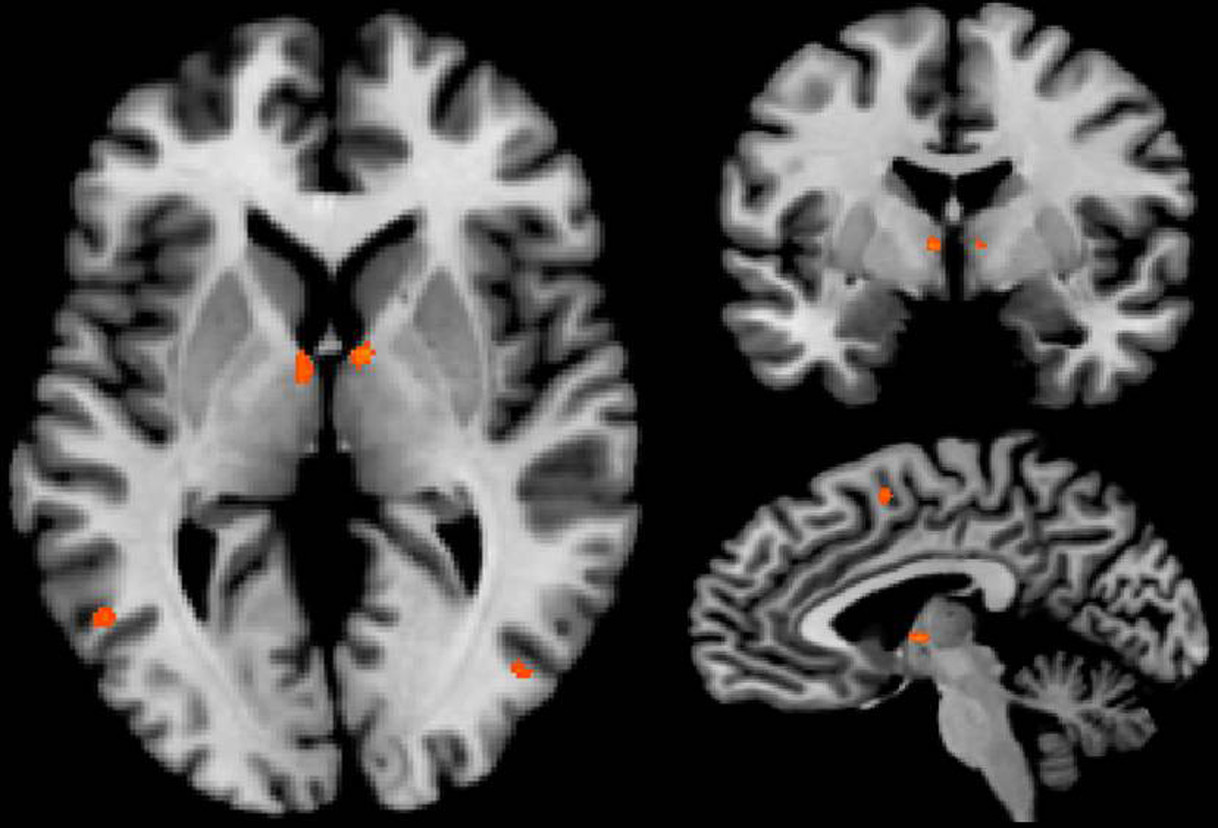 Frontiers High Field Fmri Reveals Thalamocortical Integration Of Segregated Cognitive And