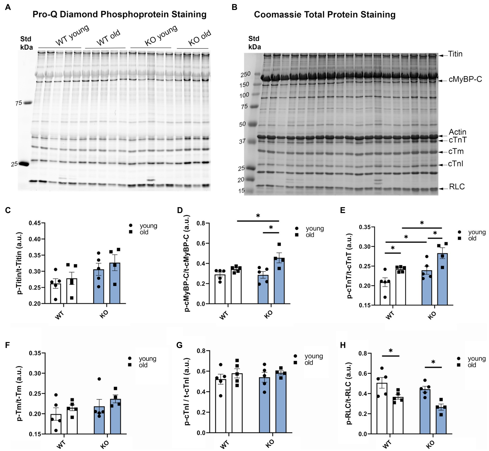 Frontiers B Arrestin 2 Signaling Is Important To Preserve Cardiac Function During Aging Physiology