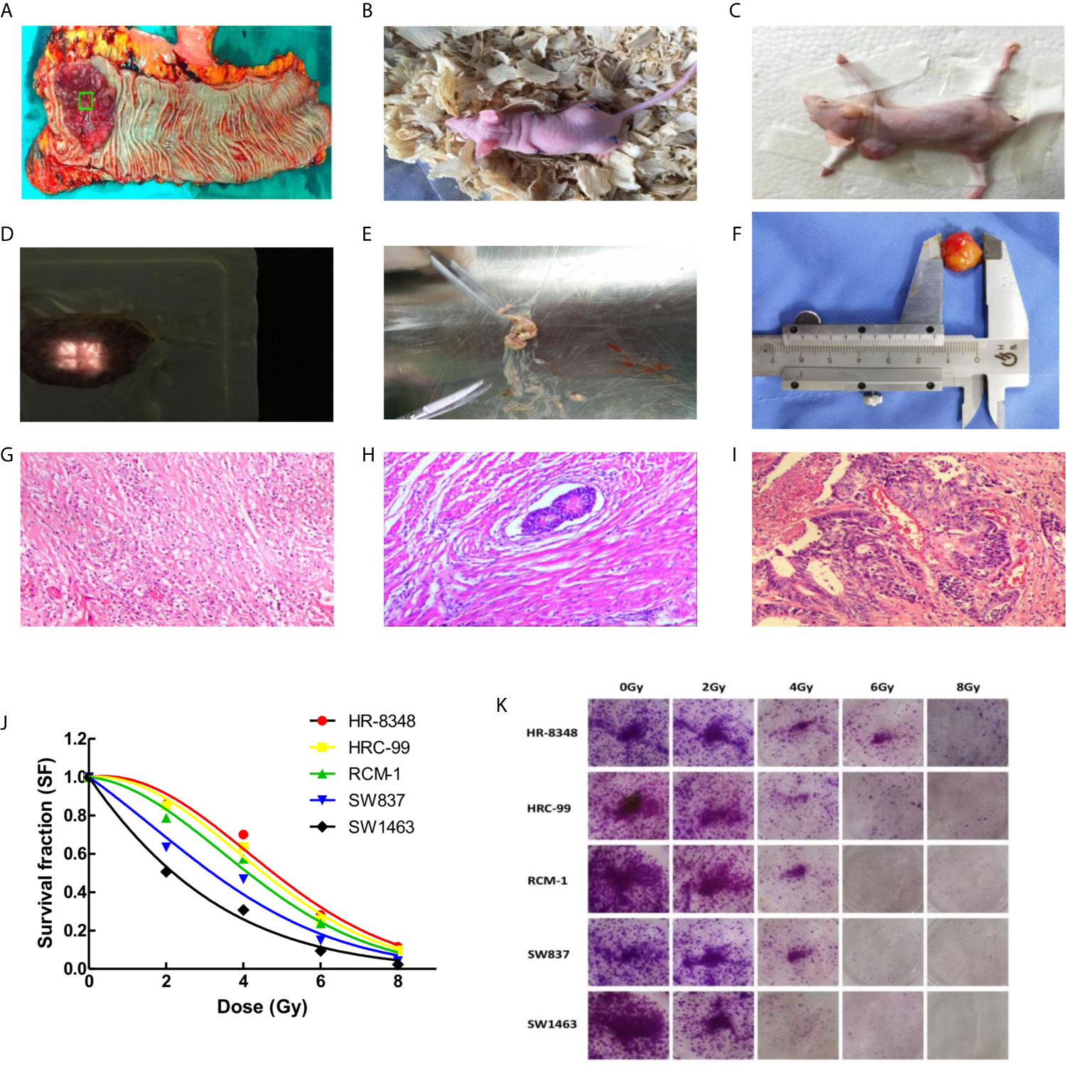 Frontiers Screening Of Microrna Related To Irradiation Response And The Regulation Mechanism Of Mirna 96 5p In Rectal Cancer Cells Oncology