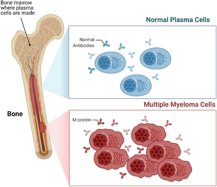 Frontiers | Mcl-1 Inhibition: Managing Malignancy in Multiple Myeloma