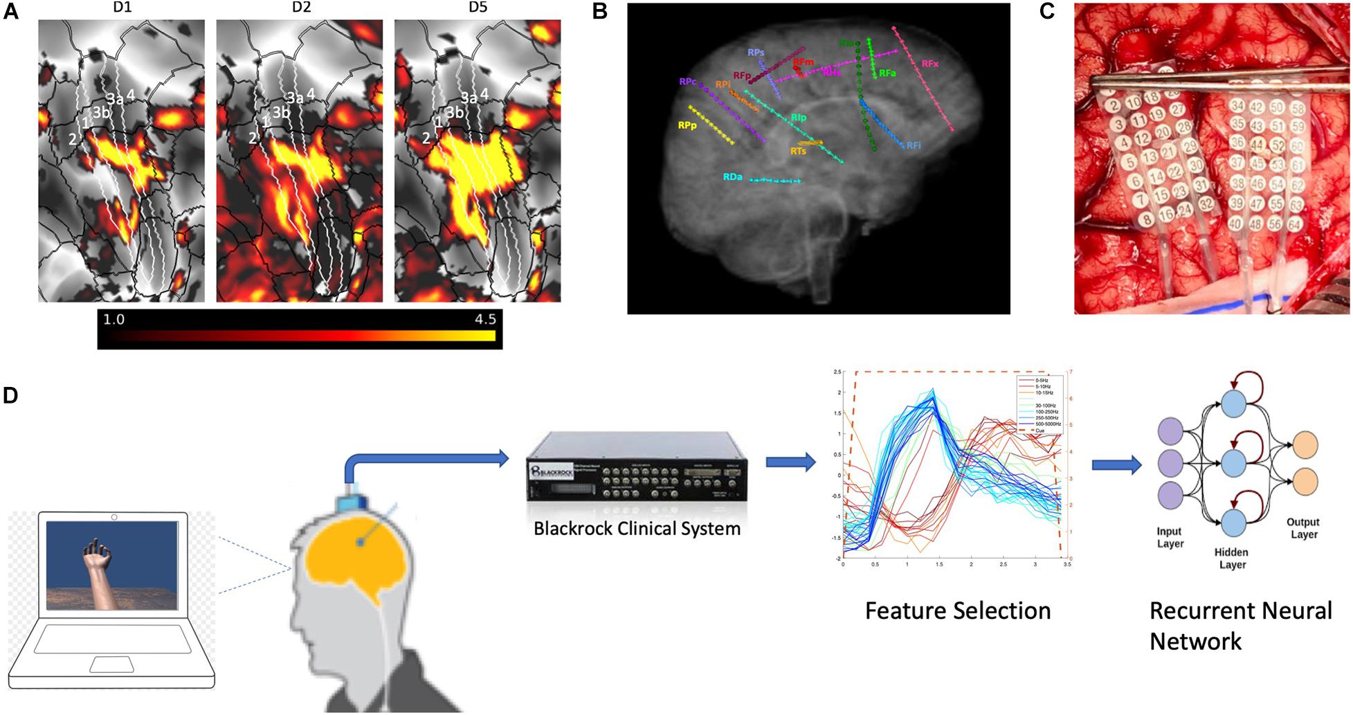 A brain-computer interface that evokes tactile sensations improves robotic  arm control