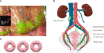 Frontiers | Sentinel Lymph Node Mapping in Endometrial Cancer: A ...
