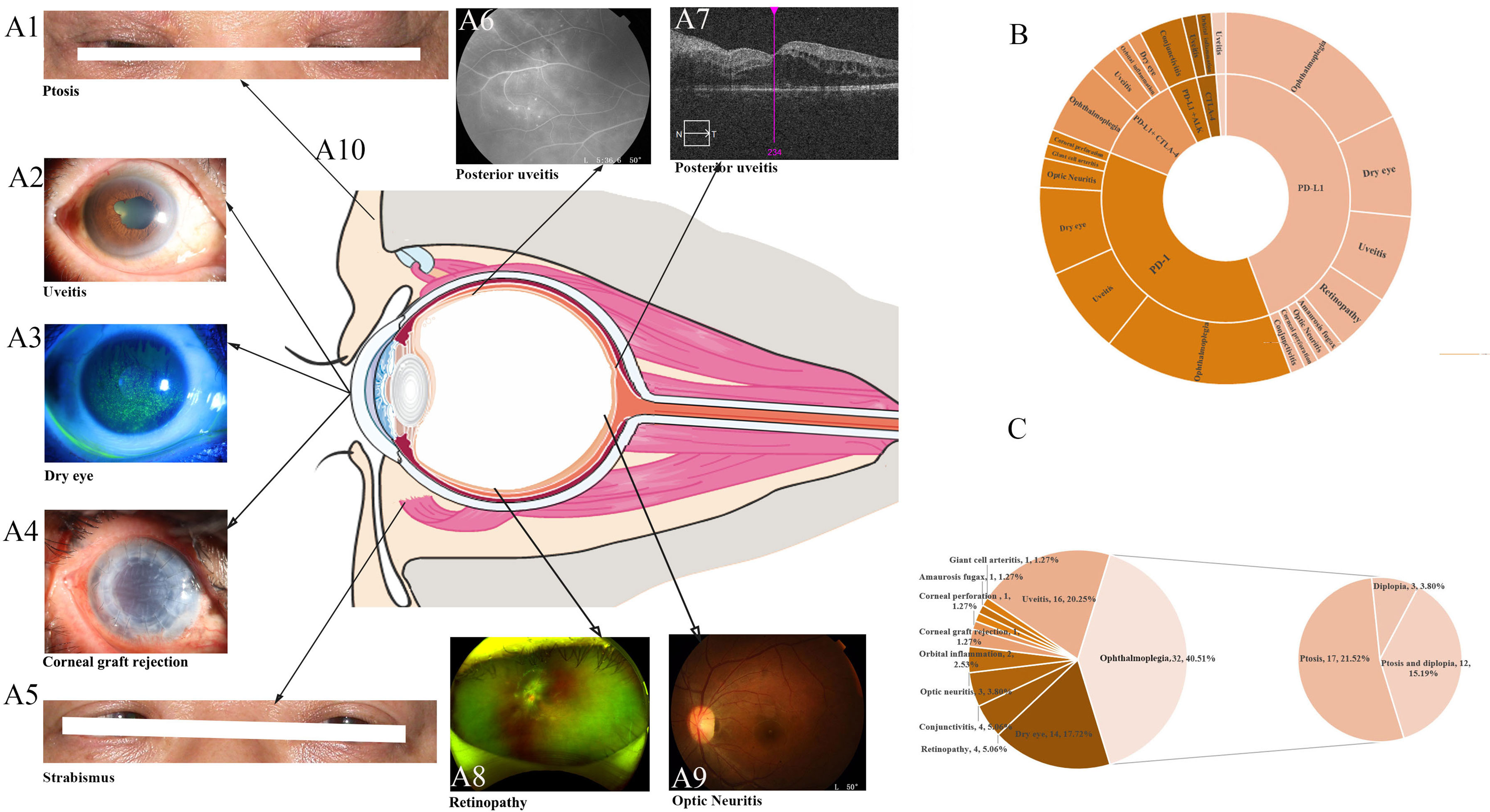 Ocular Immunology and Inflammation: Vol 31, No 6