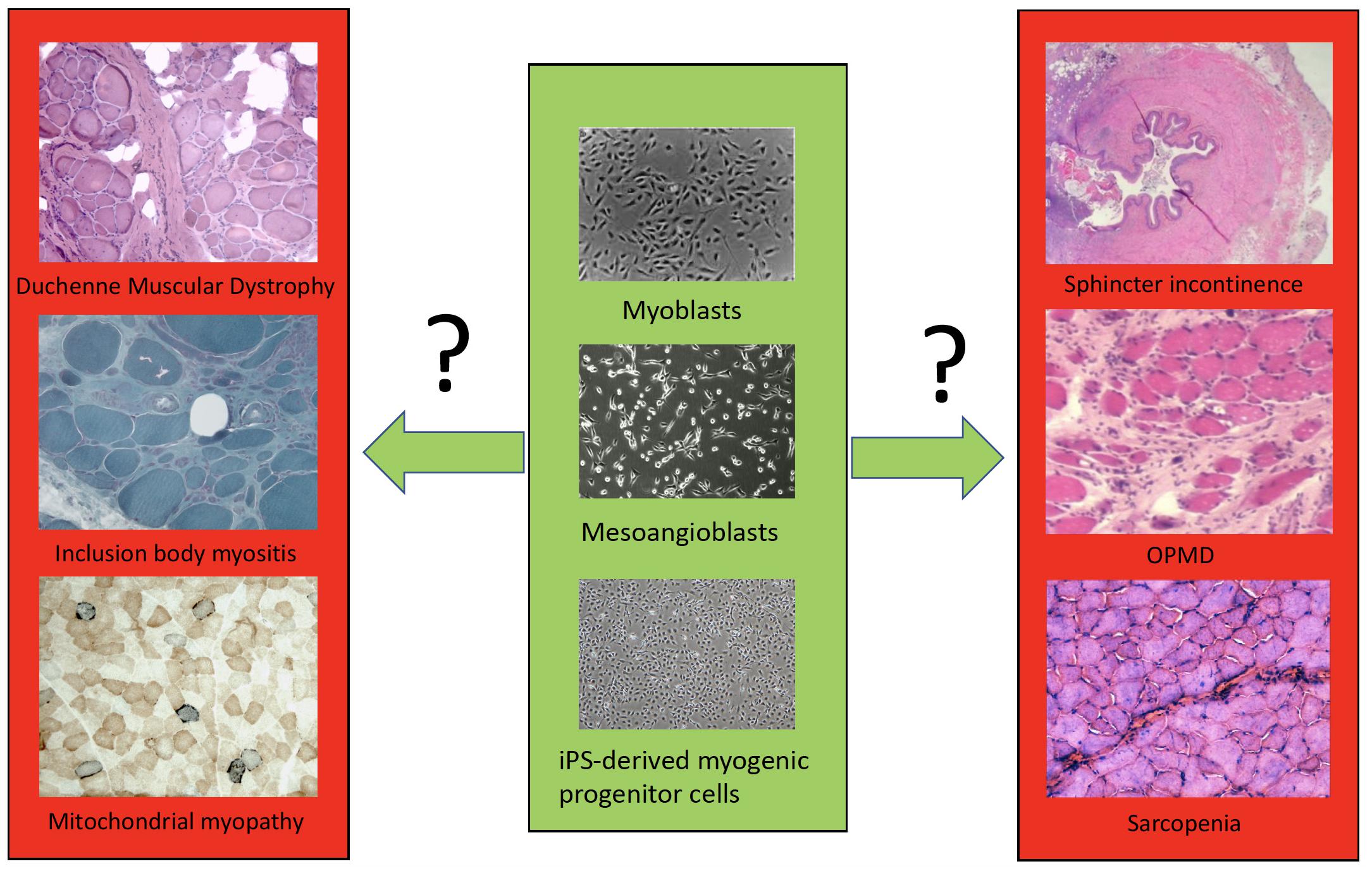 Frontiers  Myogenic Cell Transplantation in Genetic and Acquired